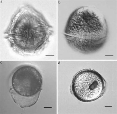   Peridinium: Elukupollille ominainen pyörivä uiminen yhdistettynä mikroskooppisen kokoiseen ulkonäköön!