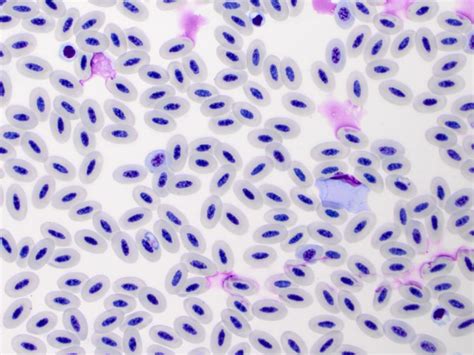  Leucocytozoon! Kuinka Tämä Pieni Loinen Kiintyy Punasoluihin Ja Määrittää Lintupopulaatioiden Kohtaloa?