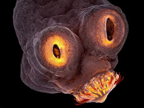  Zoogonus! This Parasite Makes You Ponder The Wonders Of Microscopic Life